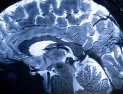 China Percepat Pengembangan Chip Otak BCI, Ilmuwan Prediksi Teknologi Ini Segera Digunakan Luas